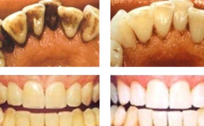 Help me become a Dental Hygienist