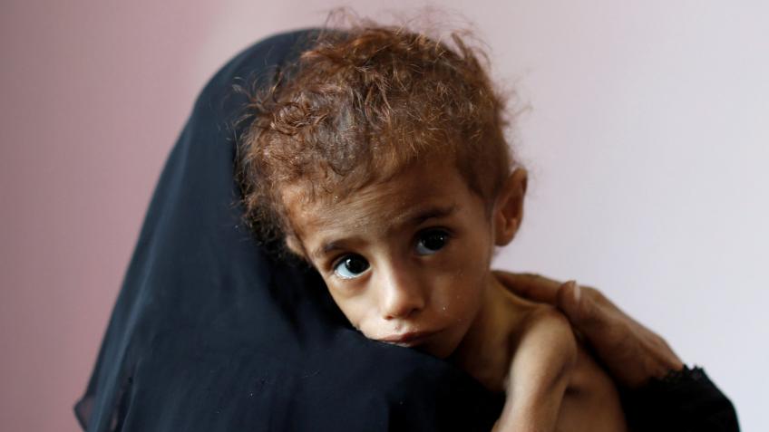 The Yemen Crisis