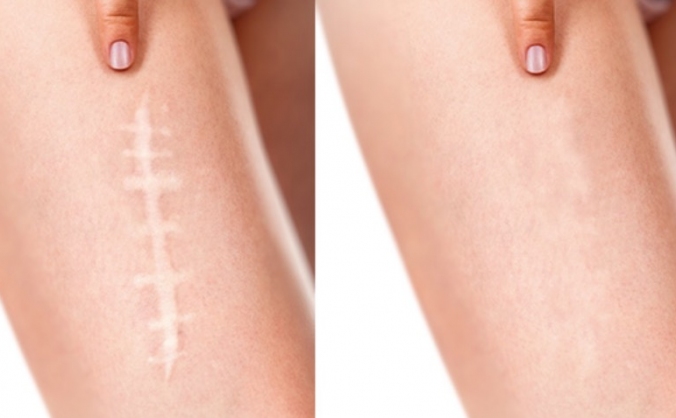 Medical Tattooist