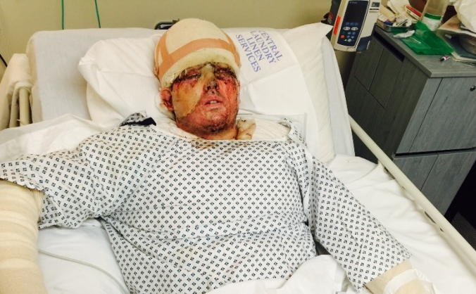 Raising funds for Andreas's Recovery