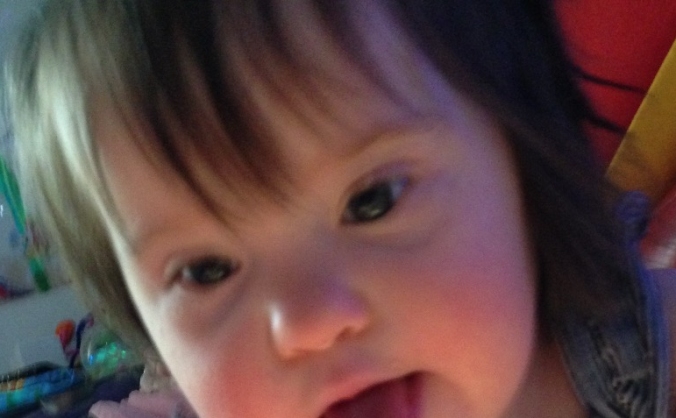 Equipment for children with Down's syndrome.