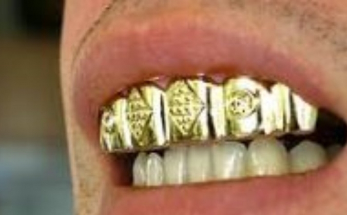 Project root canal