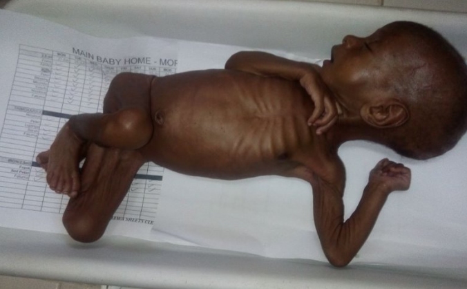 Lifesaving Nutrition for Newborn Orphans