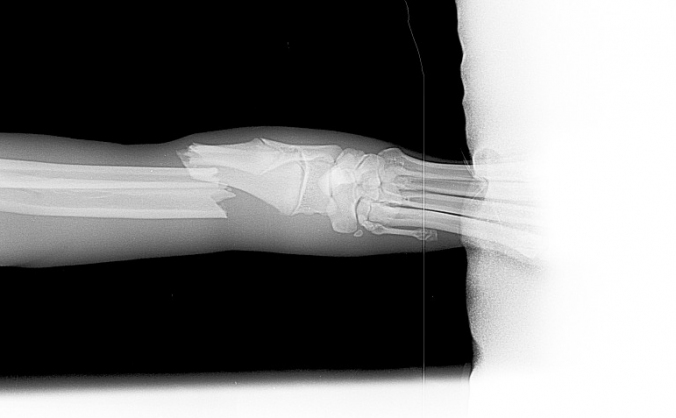 Jake's leg repair