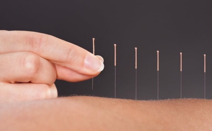 Acupuncture Degree Level Course