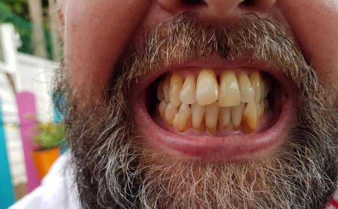 Jaws