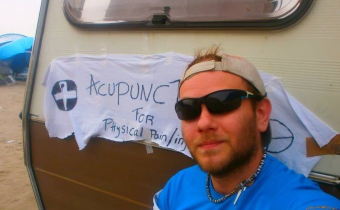Acupuncture and massage for calais refugee camp