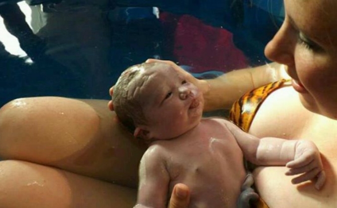 Optimal Cord Clamping/#waitforwhite campaign