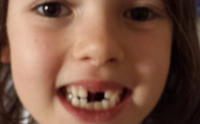 Tooth fairy homelessness project
