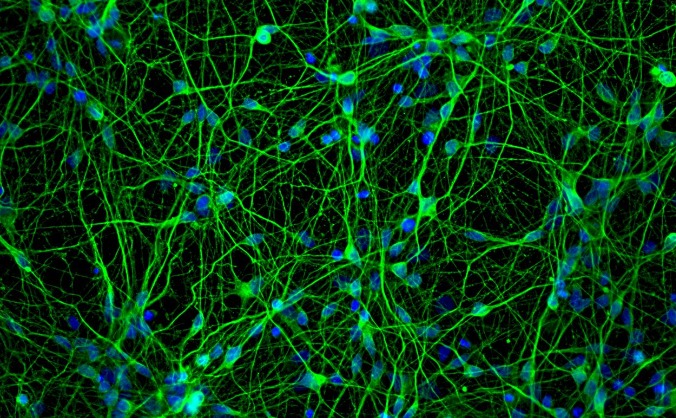 Upcoming Exhibition at UCL: Mysteries of the Mind