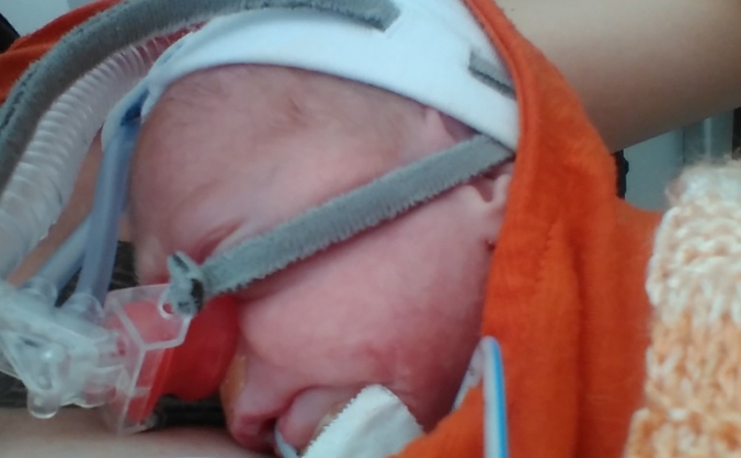 Premature Babies and their Families documentary