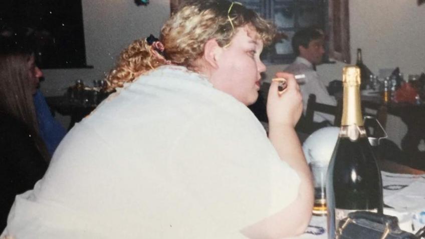 A miracle following huge weight loss