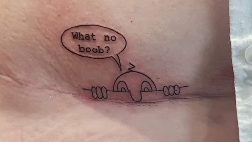 FTM Top Surgery (teet delete)