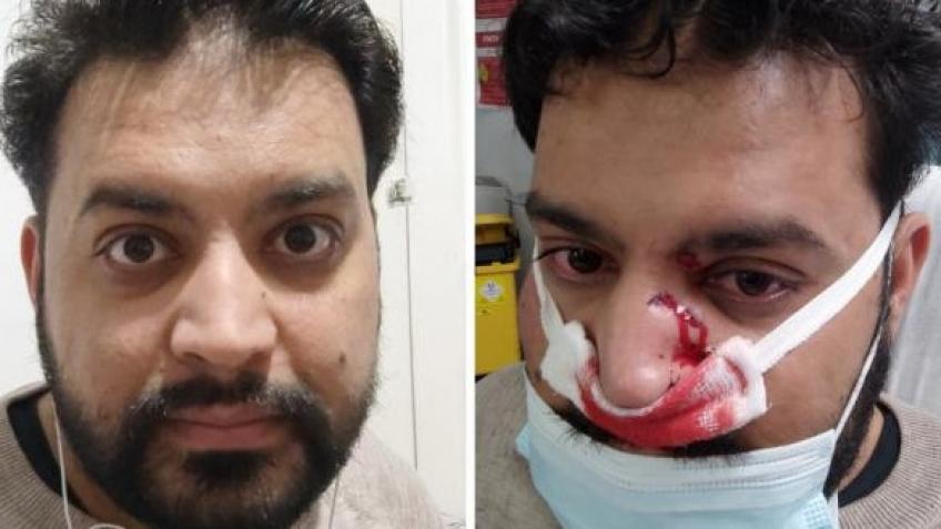 Help Mansoor overcome his brutal racist attack