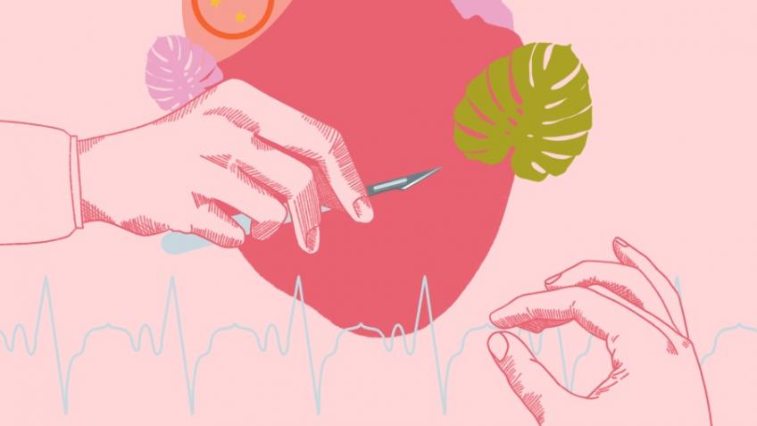 Talking Transplants at Edinburgh Fringe 2022
