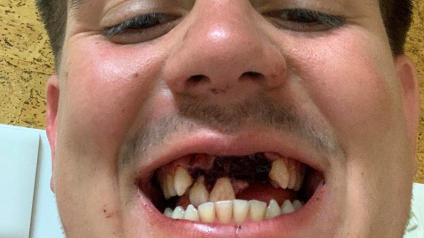 Let's get Oscar's smile back