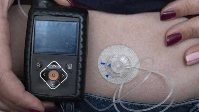 Help fund life changing treatment for Adrenal Pump