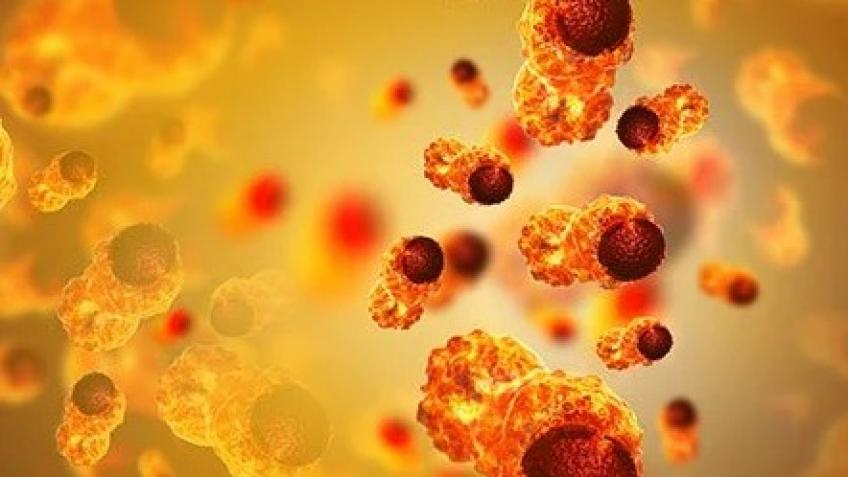 CANCER TREATMENT - SUSILA VENGATACHALAM