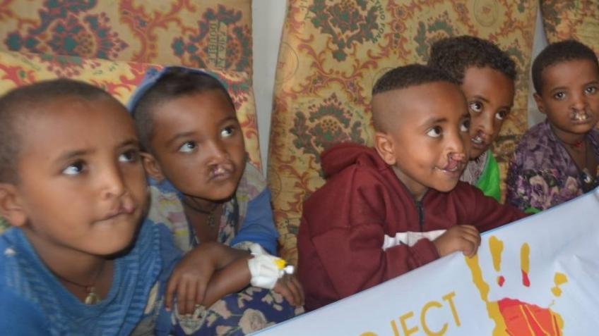 Urgent Appeal - Access to Vital Cleft Treatment