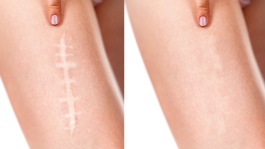 Medical Tattooist