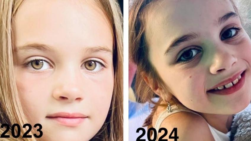 Help Esme with tick bite Lyme’s fallout (updated)