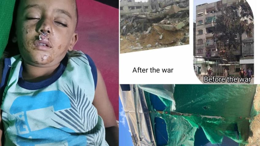 Help a prince from Gaza who suffers from cerebral