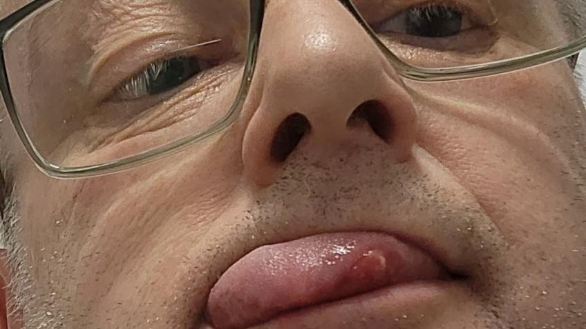 Bitting my lip