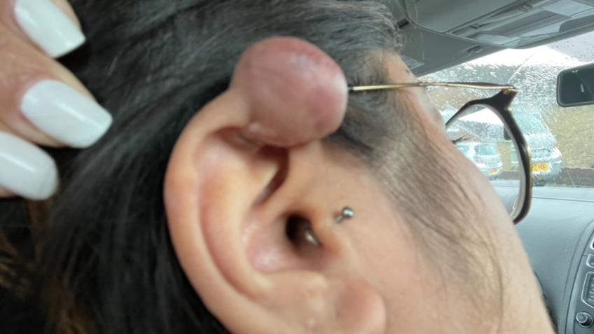 Help me get treatment for my ear