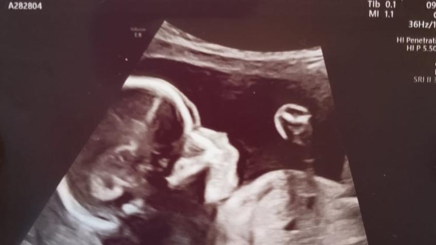 Raise funds for my friends unborn baby boy
