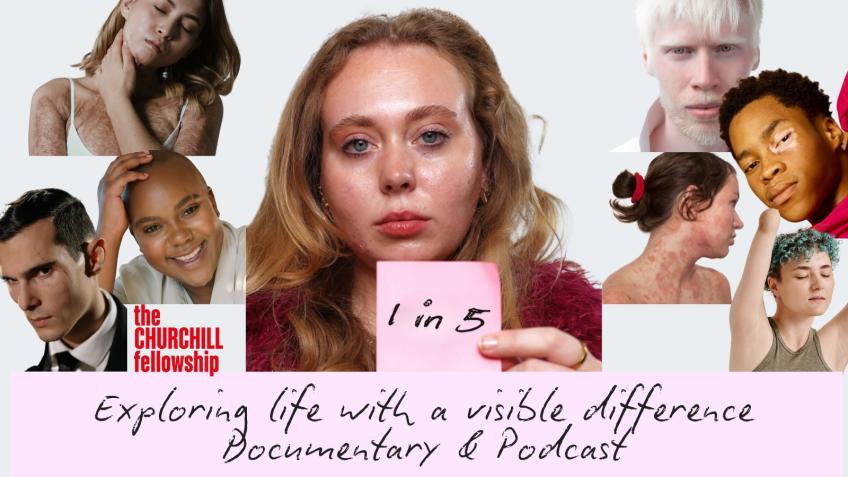1 in 5: Life With A Visible Difference Documentary