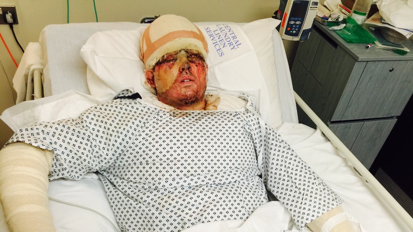 Raising funds for Andreas's Recovery