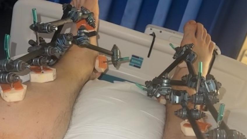 Help Mark Get Back On His Feet