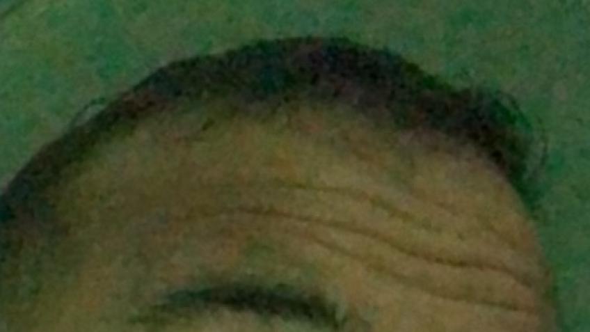 Raising hair and restoring my self esteem