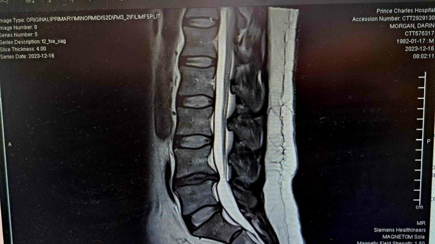Help me live pain free and work again 🙏