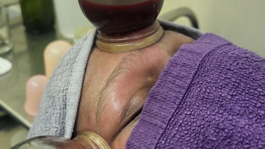 Mother of 2 stage4 Cancer Tumour in Brain