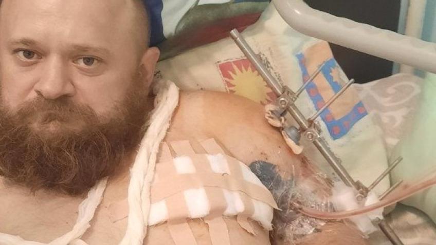 Help a Ukrainian soldier save his arm