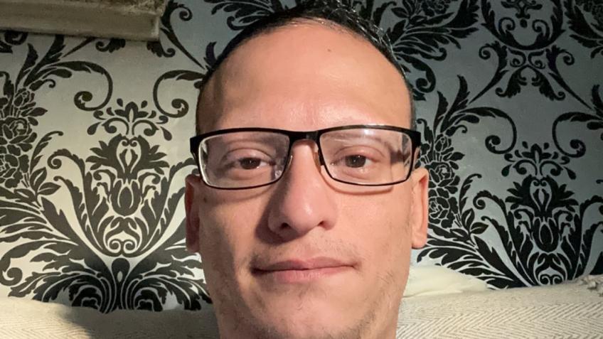 Alopecia eratica