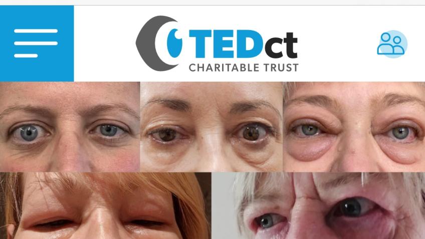 Thyroid Eye Disease Charitable Trust Fundraiser