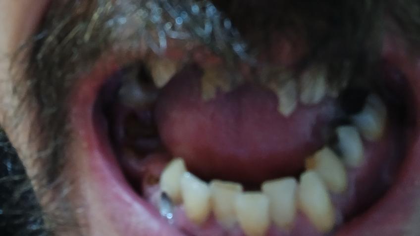 Hoping for new teeth!