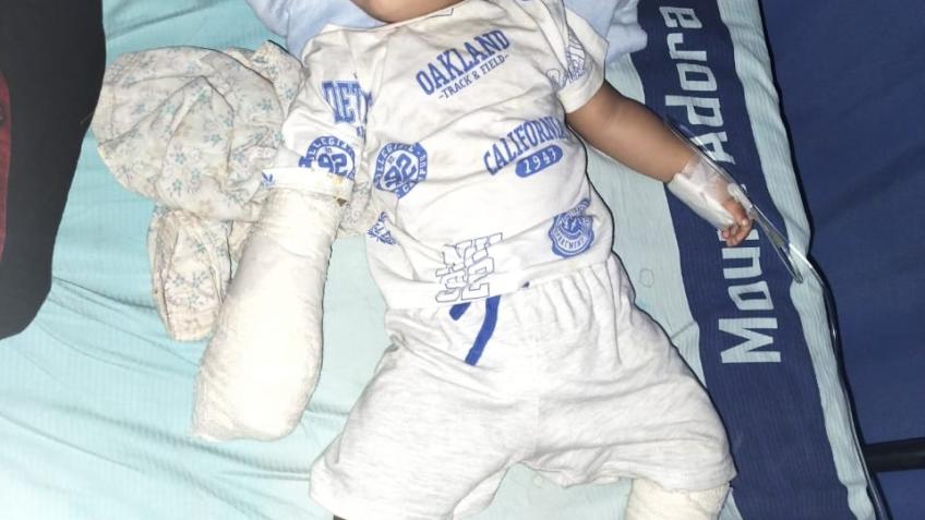 Help 15 Month Old Arman Recover from Severe Burns