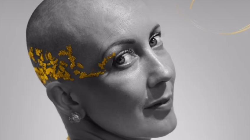 MS-UK fundraiser