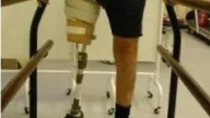 Raising funds for a Femurett device