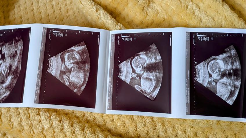 Doula fund + Statutory maternity sucks