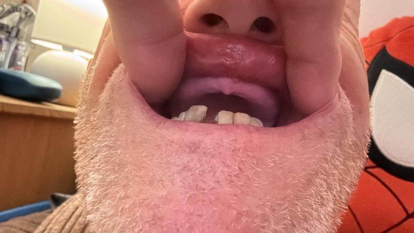 Help me smile again after 16 years