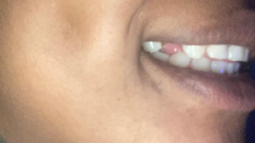 Help me smile again