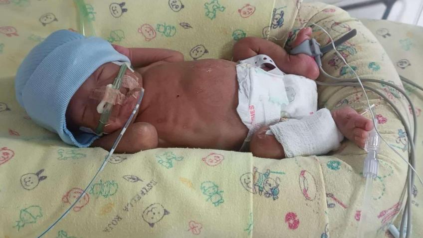 Help to save baby Eilel and support medical costs