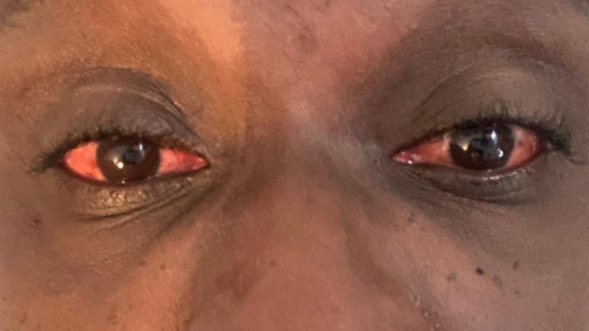 Medical and my small business