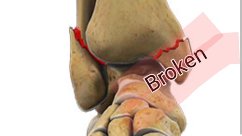 Medical expenses
