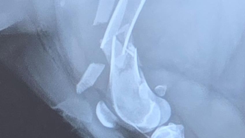 Help Bailey Recover from Her Leg Amputation