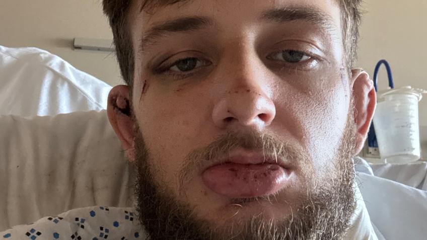 Brent’s medical expenses